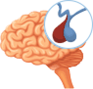 Neuroblastoma treatment effects on growth hormones